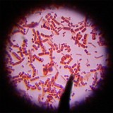 Bacteria take fantastic voyage through bloodstream