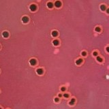 New antibiotics would silence bugs, not kill them
