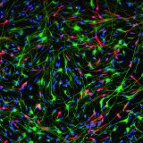 Super slow-motion camera can follow firing neurons