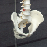 Birth trauma etched in ancient female pelvis