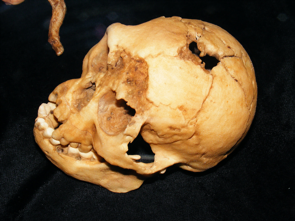 Evolutionary clues from ancestors’ brains?