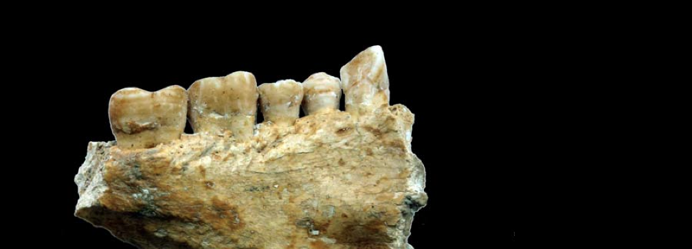 Oldest dental filling is found in a Stone Age tooth