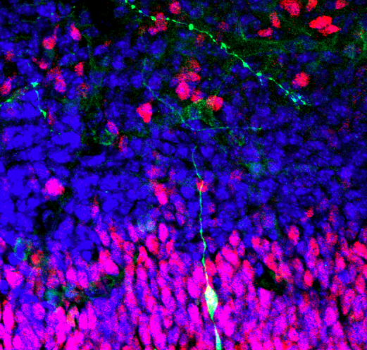 Neural stem cells pulled from rat’s brain using magnet