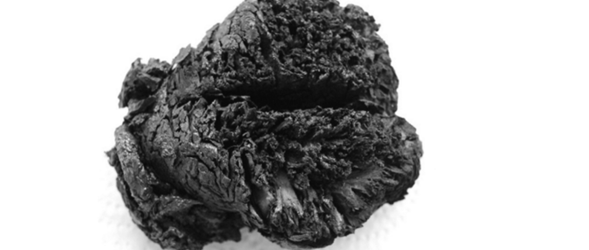 Human brain boiled in its skull lasted 4000 years