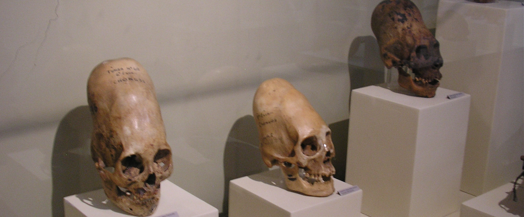 Why early humans reshaped their infants’ skulls