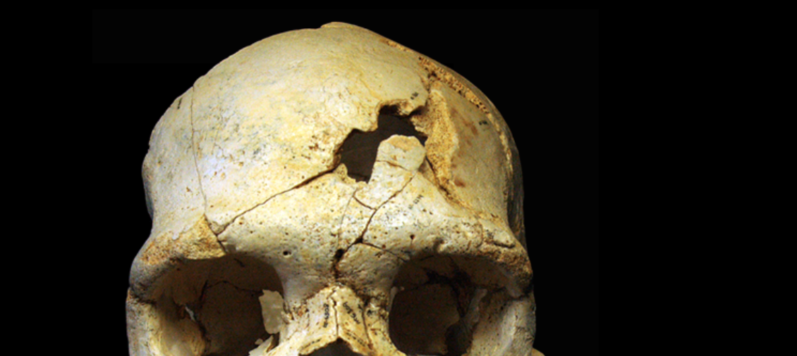 CSI Stone Age: was 430,000-year-old hominin murdered?